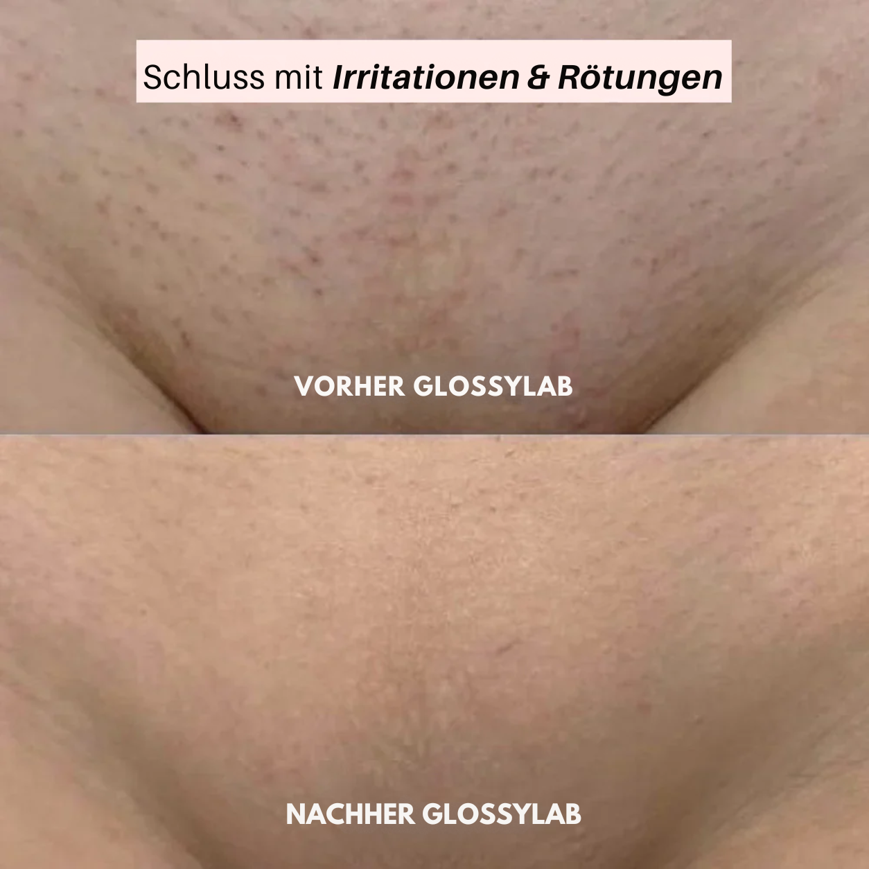GlossyLab® 2-in-1 Rasierer