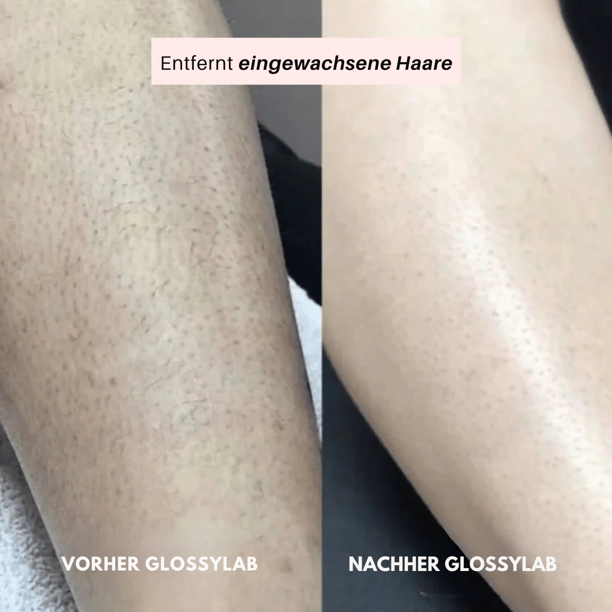 GlossyLab® 2-in-1 Rasierer