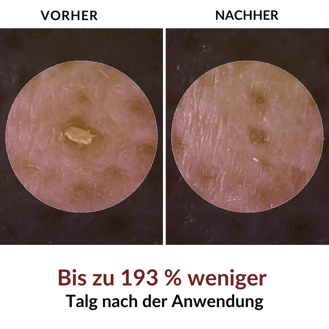 Peel Shot Koreanisch – Beseitigt Unreinheiten und verschönert Ihre Haut