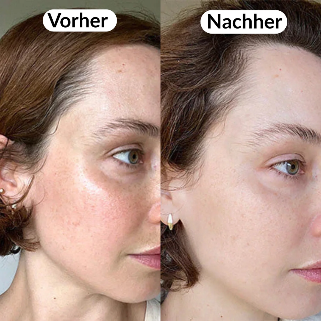 Peel Shot Koreanisch – Beseitigt Unreinheiten und verschönert Ihre Haut